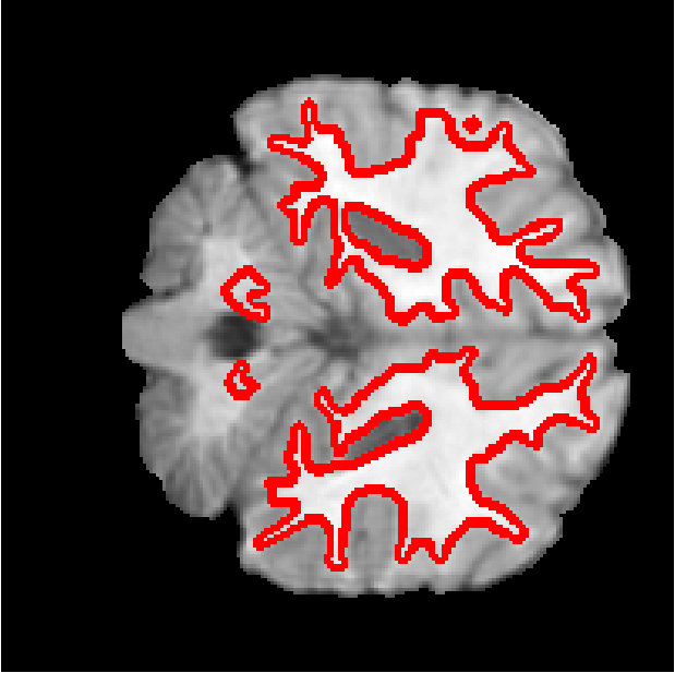 Figure 28